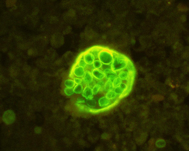  Endospory Coccidioides